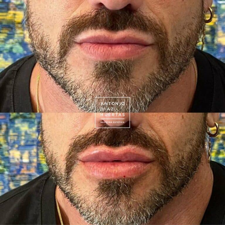 labios hombre